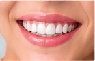 Estética dental